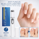 kalk nagel Schimmel Nagel Blue Light Laser Pen voor Niet-Invasieve Nagelverzorging