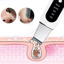Ultrasone Huidscrubber - DermaWave - Gezichtsreiniger - Mee-Eter Verwijderingstool