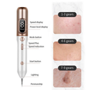 Draagbare Plasma Beauty Pen voor Persoonlijke Huidverzorging & Beautyverzorging