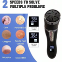 Electric Foot Callus Remover with Dust Collector, LCD Screen and USB Rechargeable Pedicure
