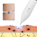 Laser Plasma Pen - DermaVolt - Huidverzorging - Pigmentvlek Verwijderingstool